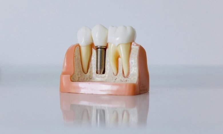 affordable dental implants hungary